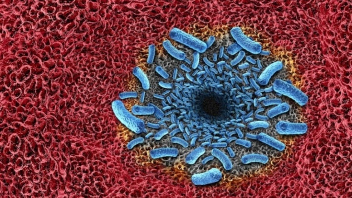 vibrio vulnificus bakterisi