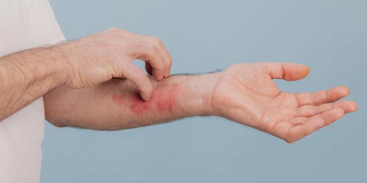 tahta kurusu belirtileri